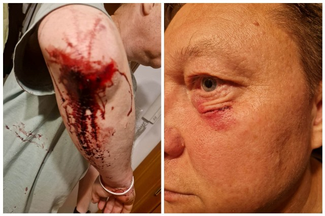 IУ Варшаве збілі беларуса з Віцебску